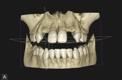 3d porn x ray|3d X Ray Porn Videos .